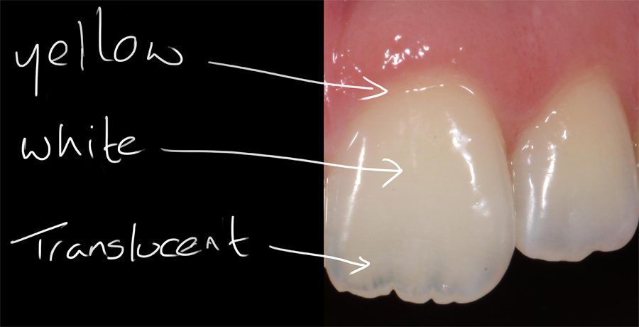 Cosmetic Dentist in London