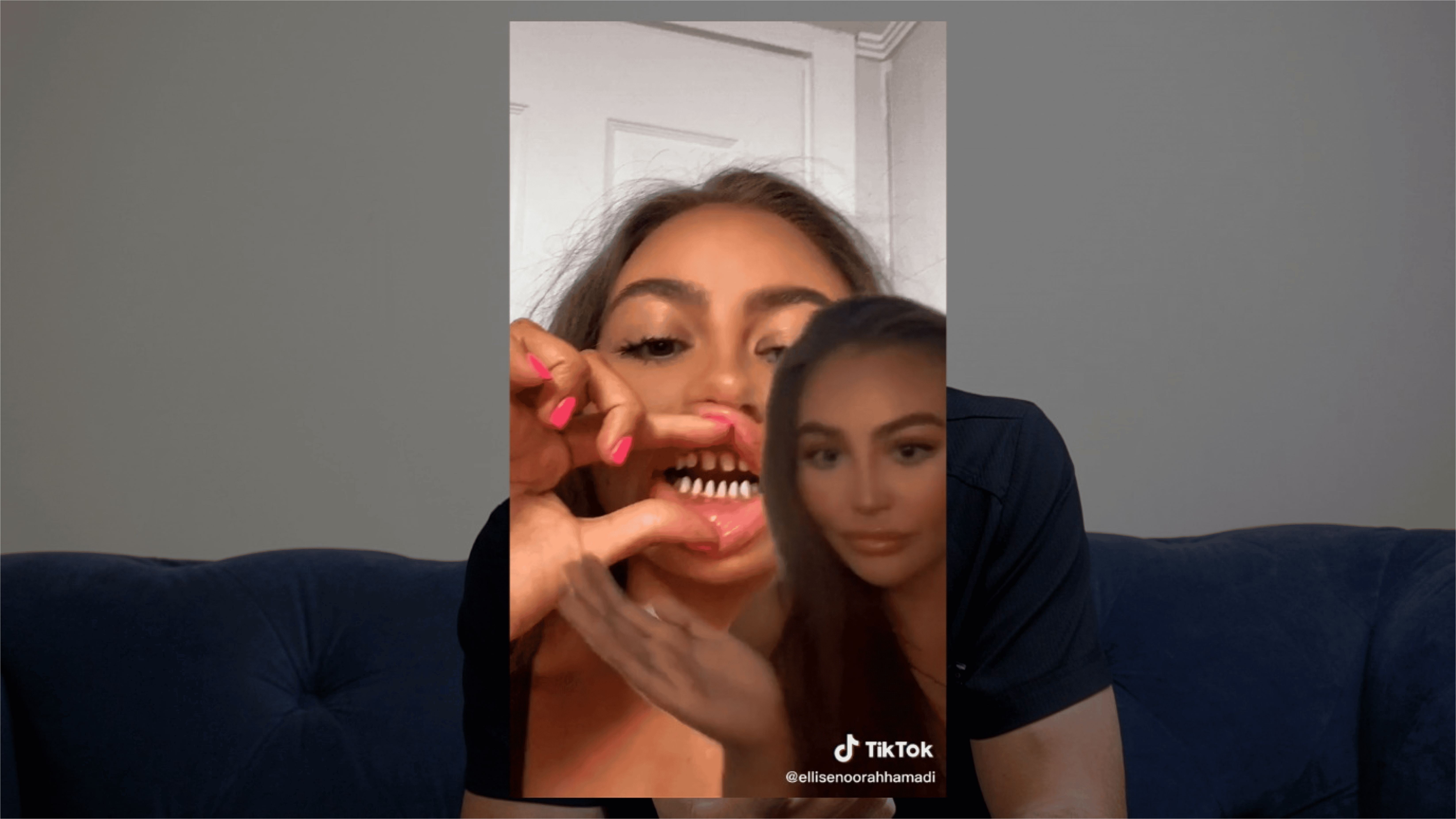 How Many Veneers Do You Need For a Perfect Smile? 2