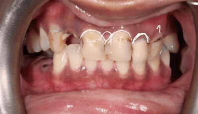 Designing a Perfect Smile - Dr Gurs Sehmi 6 Designing a Perfect Smile - Dr Gurs Sehmi 6
