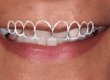 Designing a Perfect Smile - Dr Gurs Sehmi 5